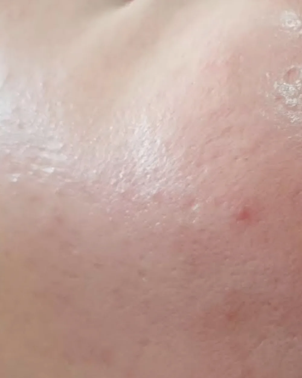 BB Glow – before