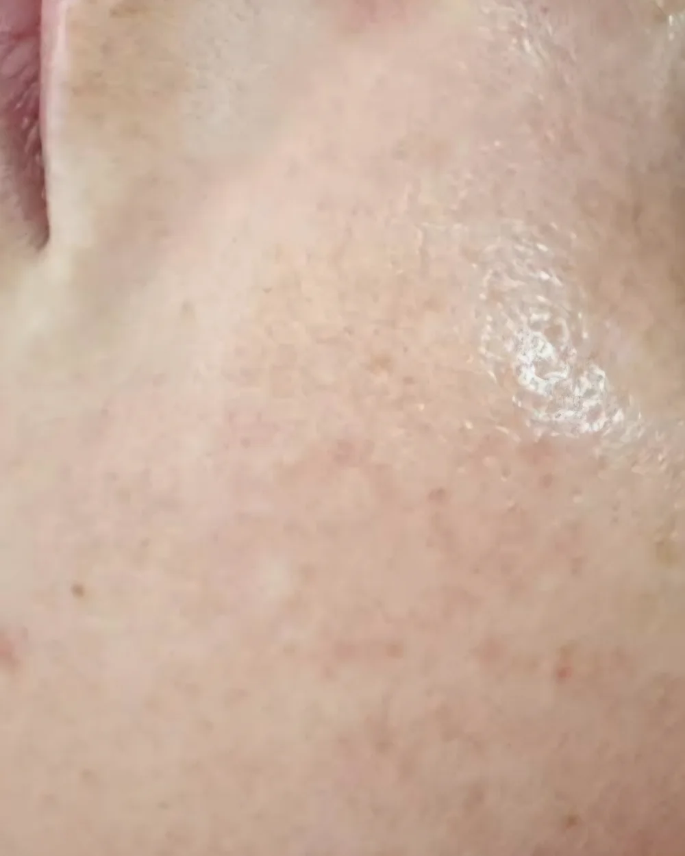 BB Glow – before