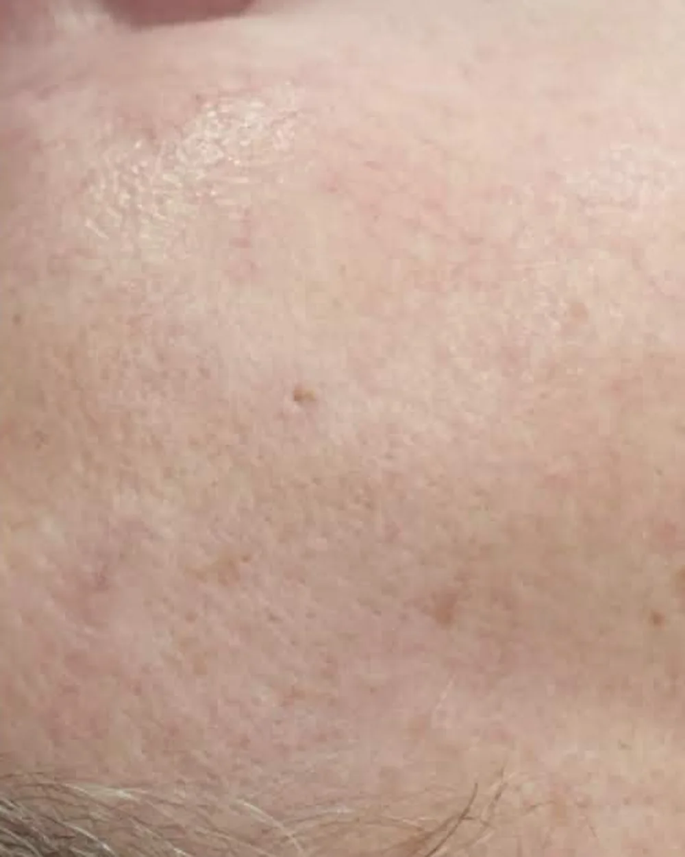BB Glow – before