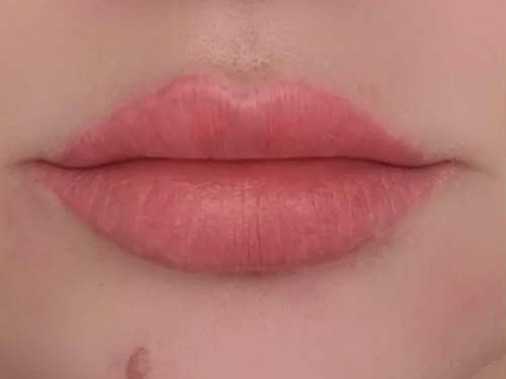 BB Lips – before
