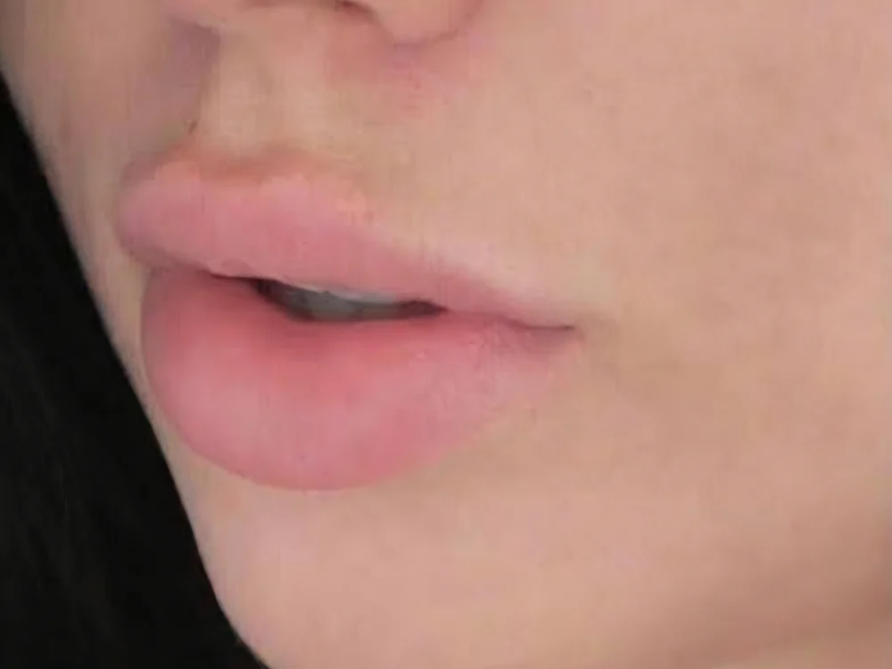 BB Lips – before
