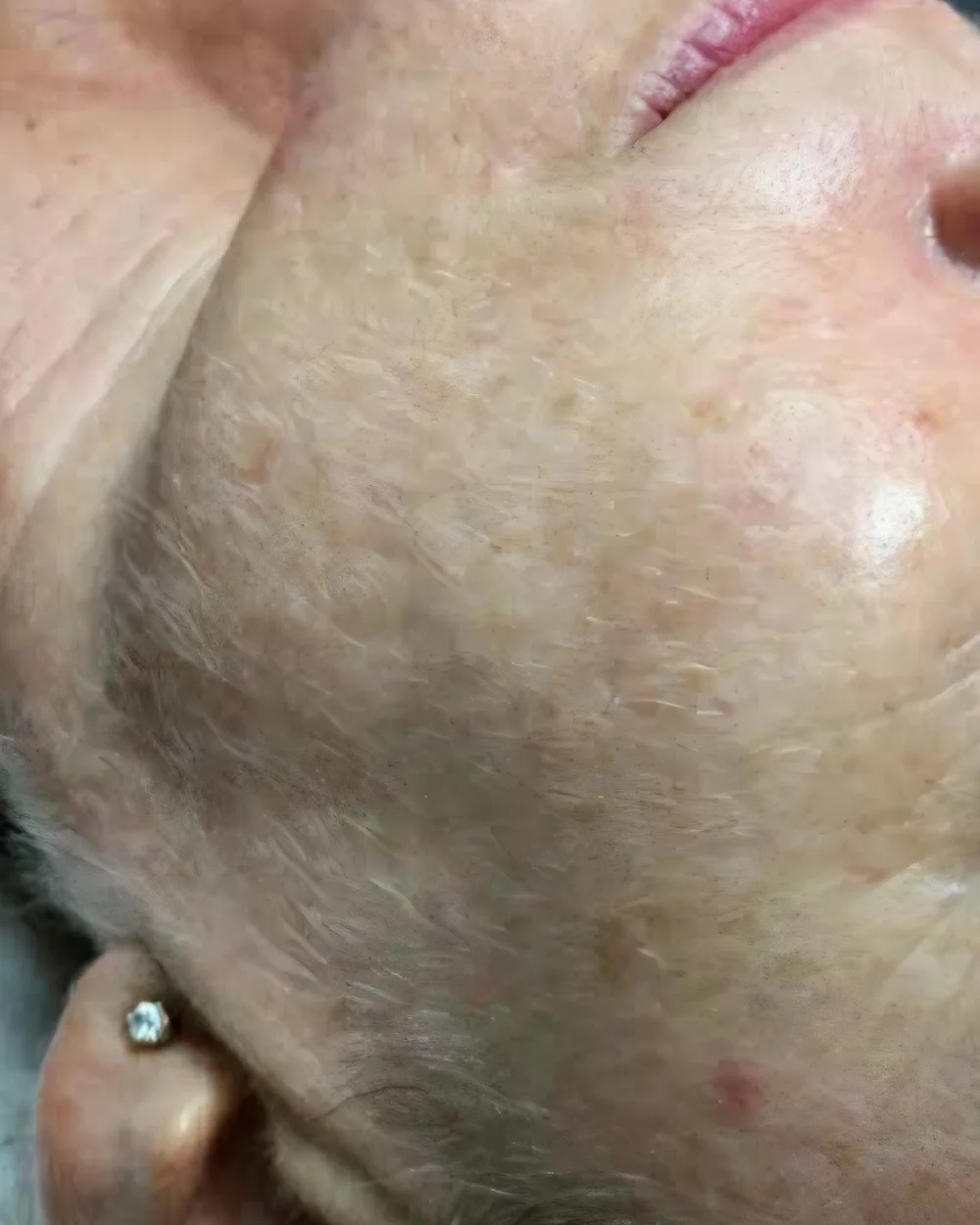 Baby Soft Skin – before