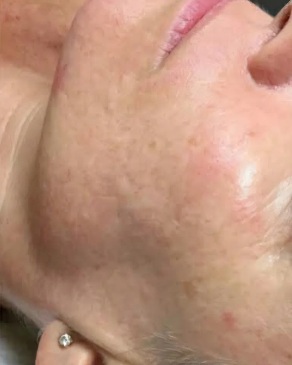 Baby Soft Skin – after