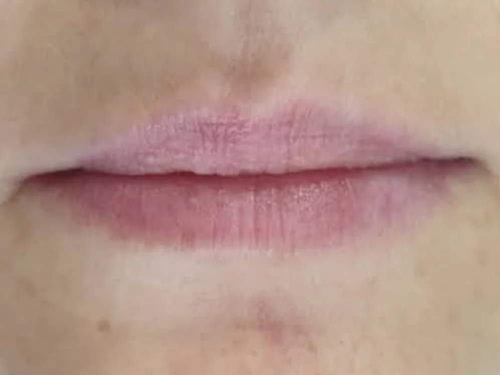 Lip Booster – before