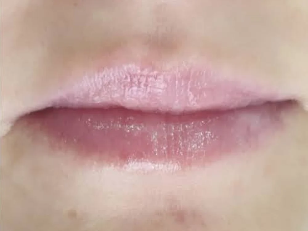 Lip Booster – after