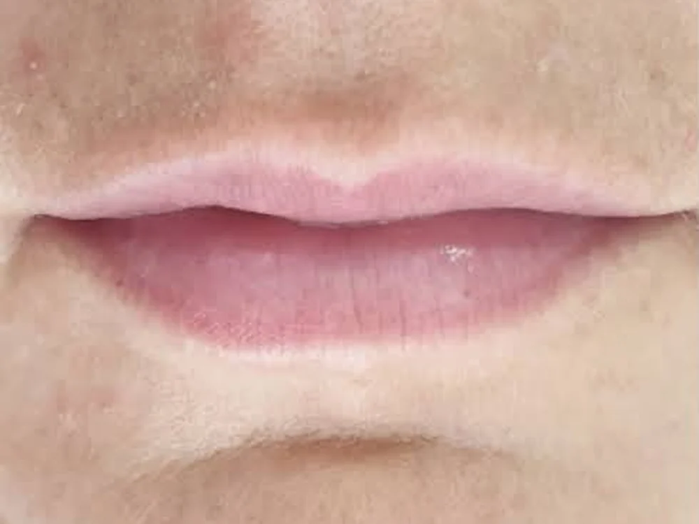 Lip Booster – before
