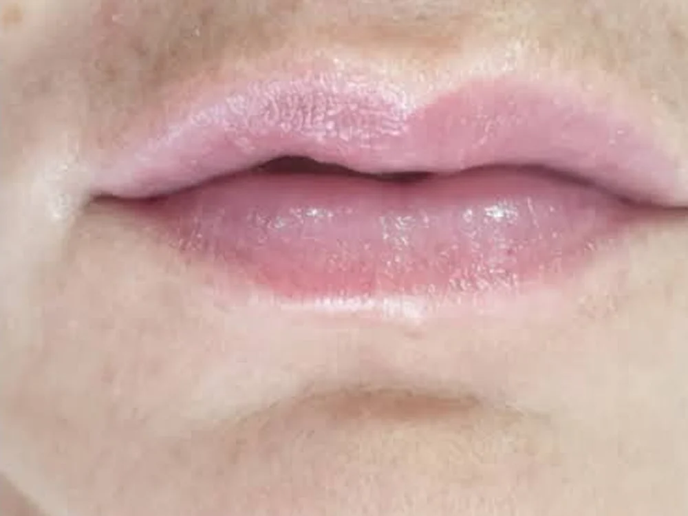 Lip Booster – after
