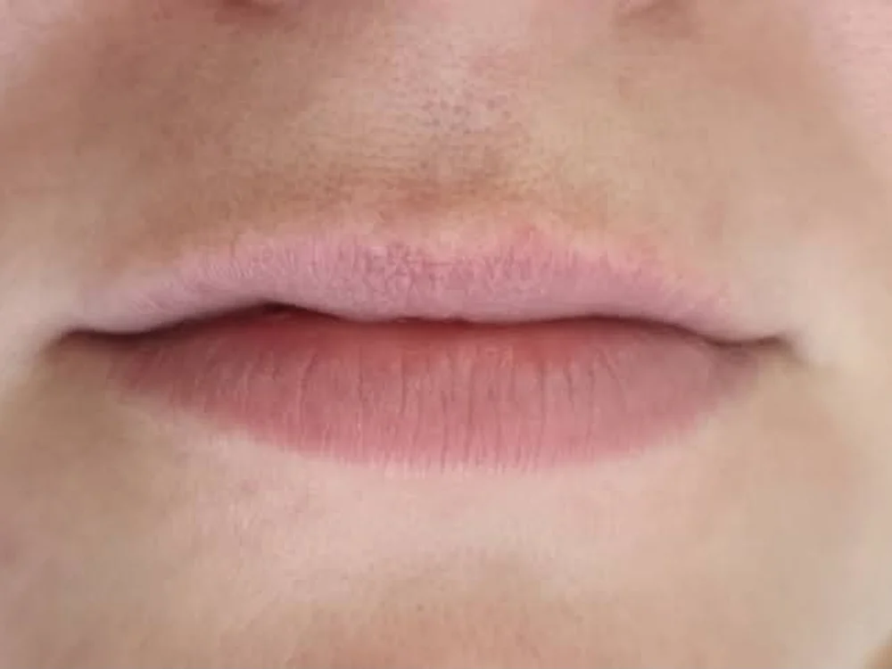 Lip Booster – before