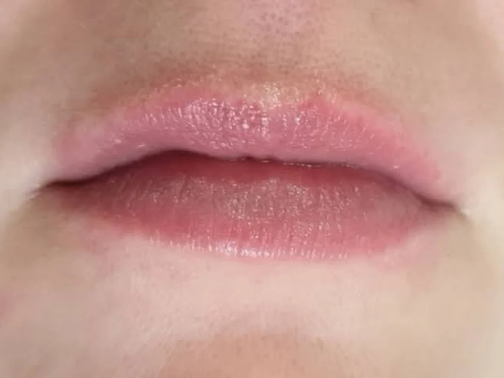Lip Booster – after