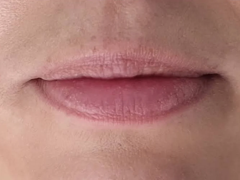 Lip Booster – before