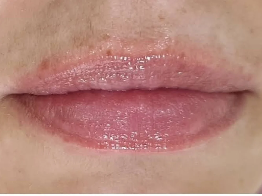 Lip Booster – after